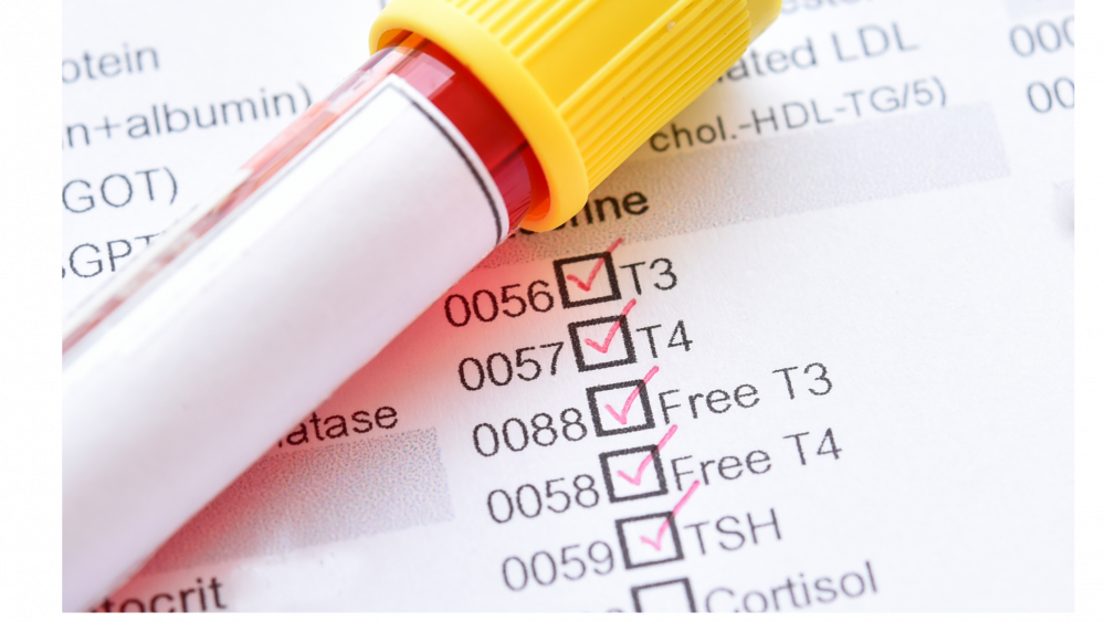 Thyroid Testing Panel